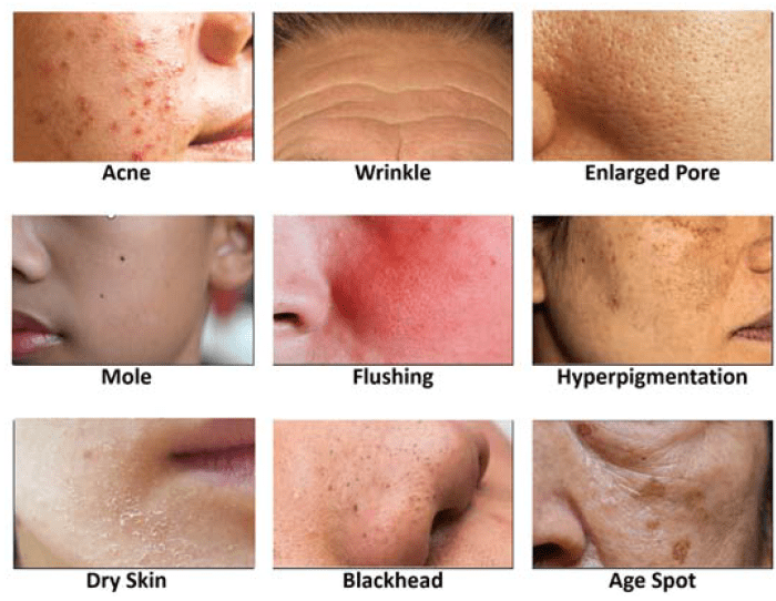 Remedies herpes remedios caseros alimentos tratamiento aclarar consumir savy saludaio herbal